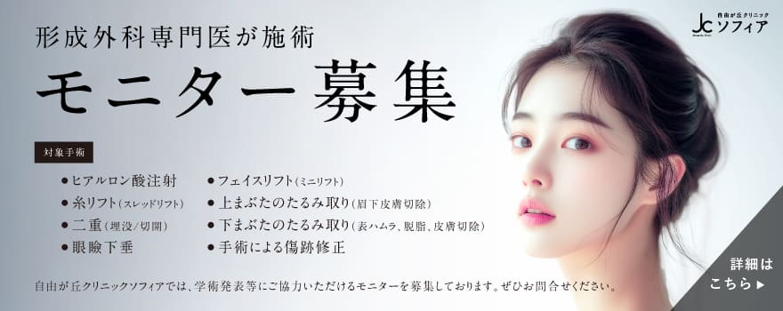 モニター募集