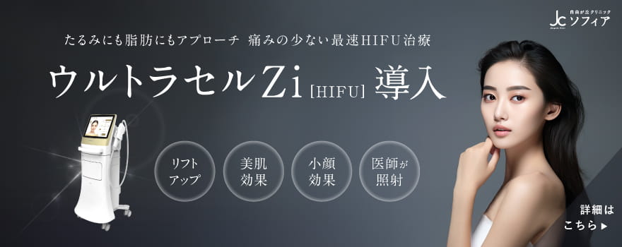 ウルトラセルZi導入