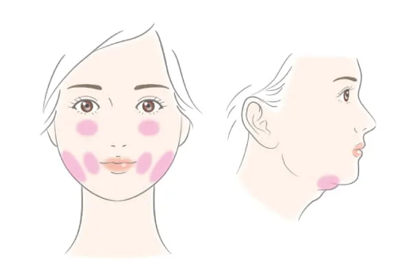 対応可能な部位の画像