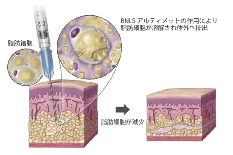 効果のイメージ図