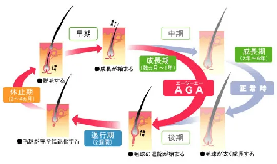 agaのメカニズム