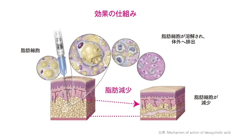 チンセラプラスの作用イメージ