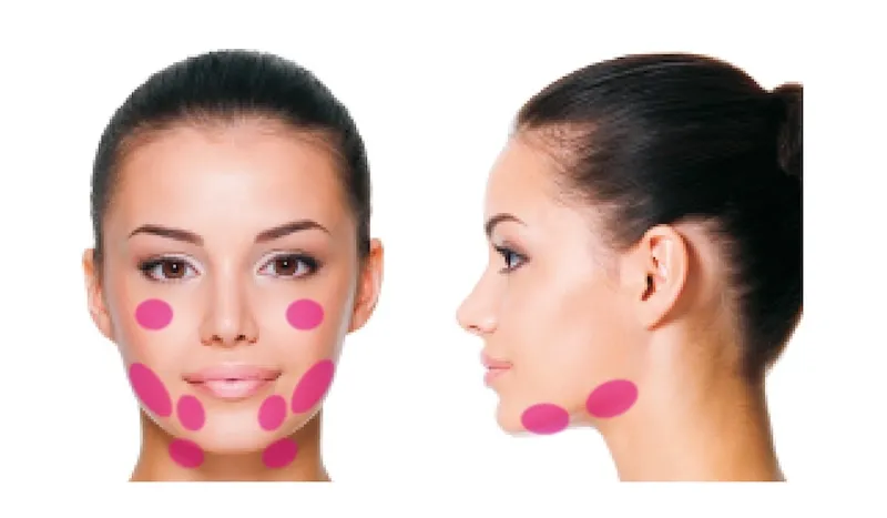 チンセラプラスの適応部位画像