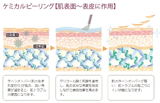 ケミカルピーリングの作用