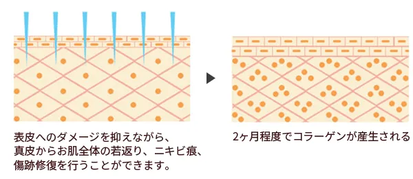 仕組みのイメージ画像