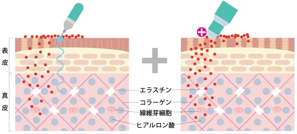 メソナJ（MESONA-J）の仕組み