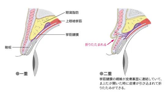 一重と二重の構造イメージ