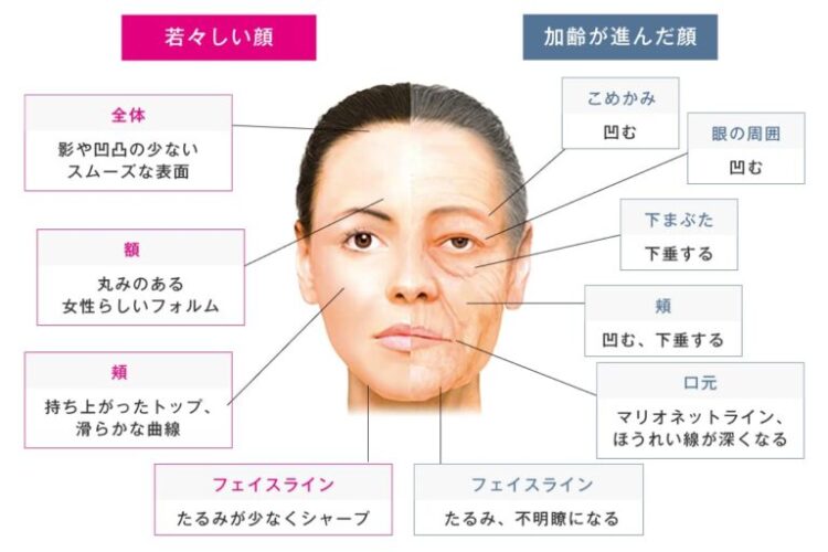 ヒアルロン酸注射の効果を現すイメージ図