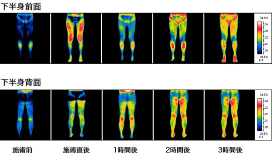 サーモグラフィーの様子