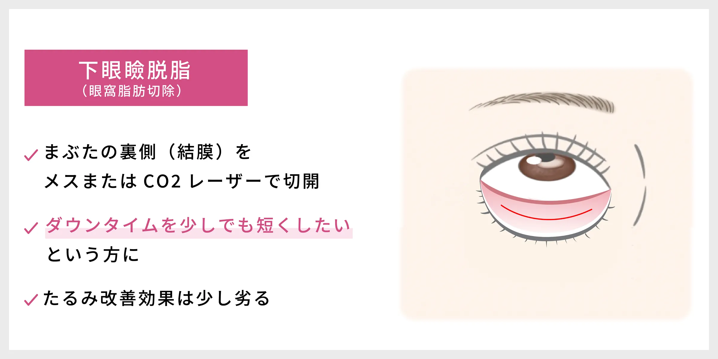 下眼瞼脱脂（眼窩脂肪切除）の治療詳細