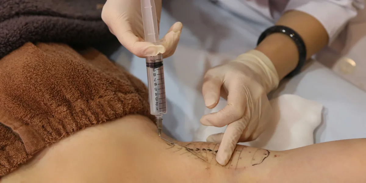 西千葉にある自由が丘クリニックソフィアの医師によるミラドライ