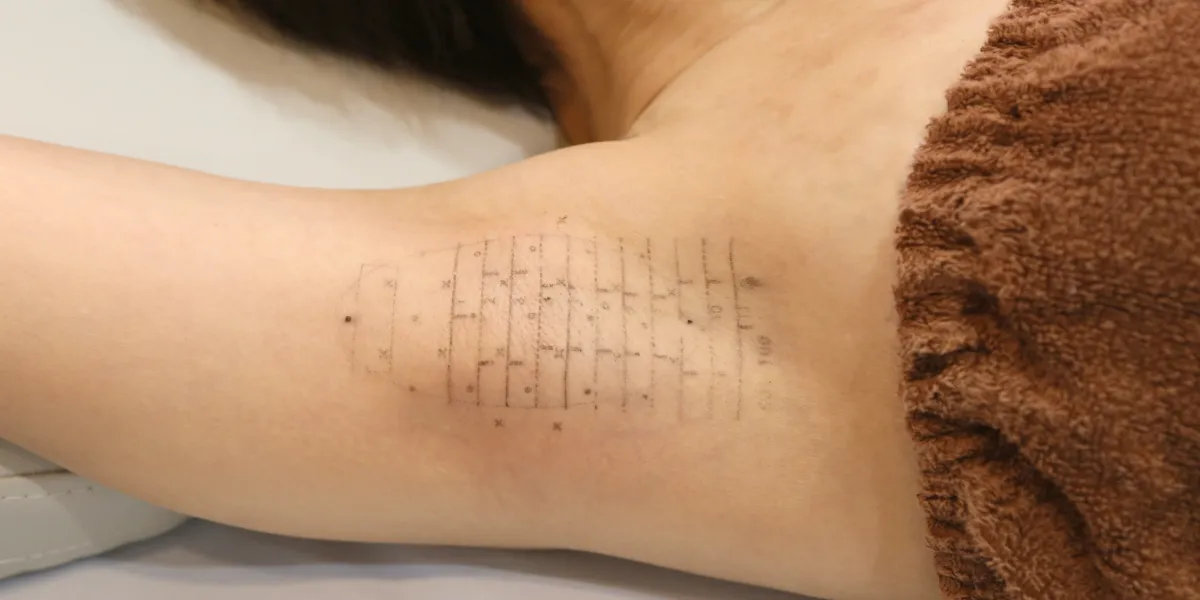 治療範囲を決めいている様子