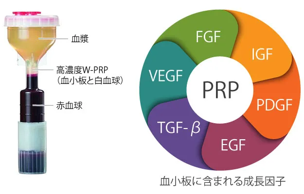 高濃度W-PRP療法の成分イメージ