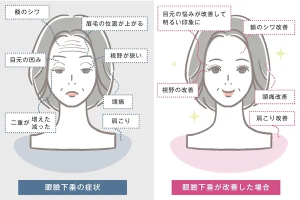 顔に現れる不調のイメージ画像