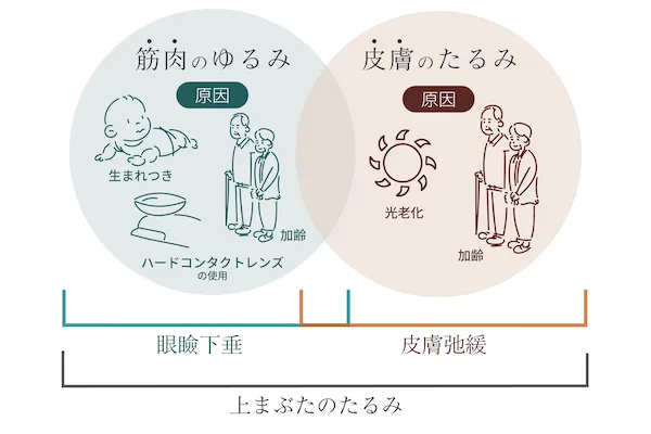 筋肉のゆるみ・皮膚のたるみのイメージ画像