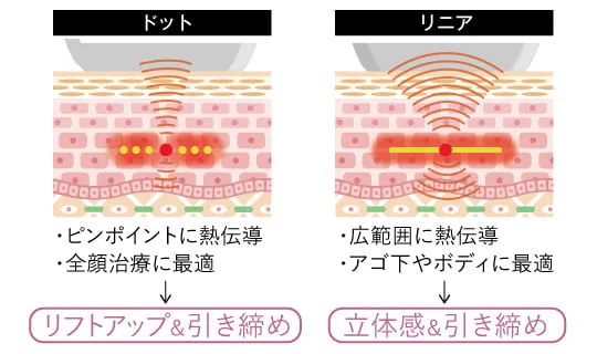 ウルトラセルZiの説明画像