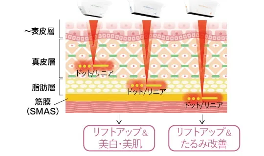 ウルトラセルZiの仕組み