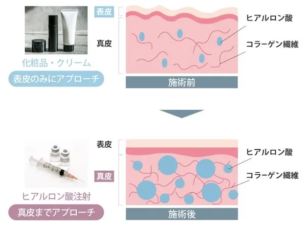 ボライトXCの特徴、作用、仕組み画像