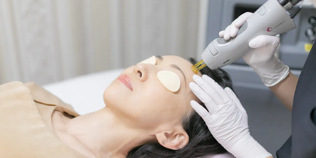 YAGレーザーをしている様子