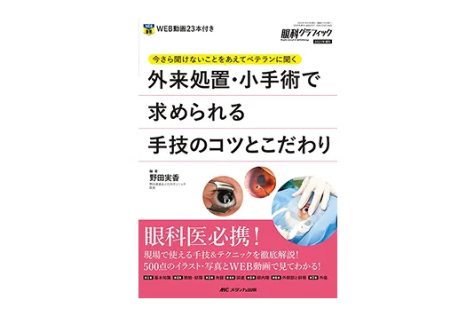 眼科グラフィック 外来処置・小手術で求められる手技のコツとこだわり