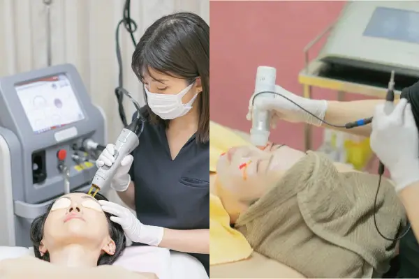 レーザーフェイシャル＆メソナJ施術風景