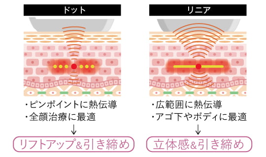 ウルトラセルZiの効果