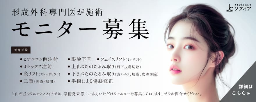 モニター募集