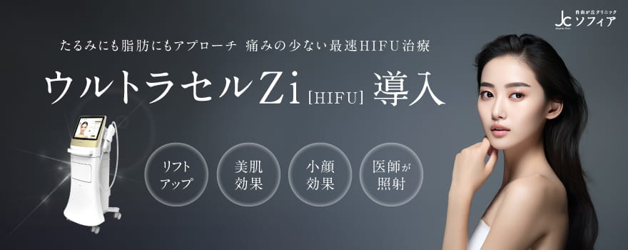 ウルトラセルZi導入
