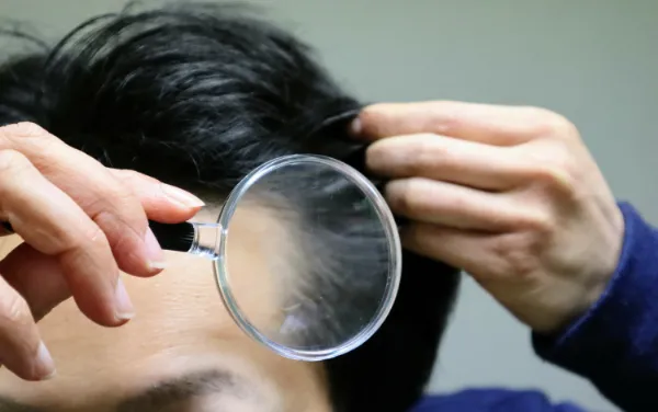 生え際が薄くなっている男性