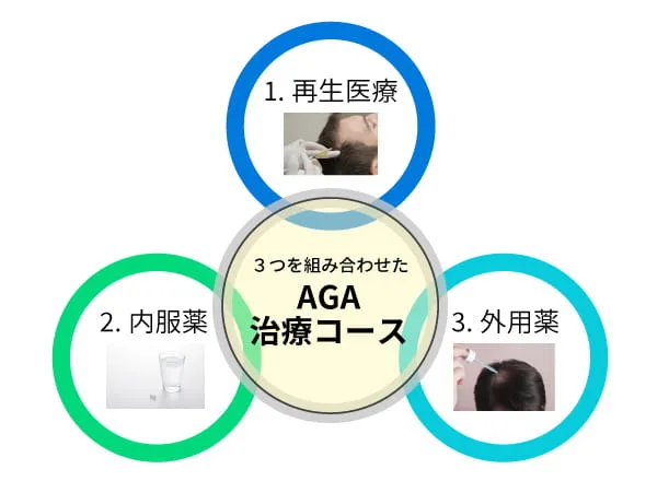 自由が丘クリニックソフィアのAGA治療コース