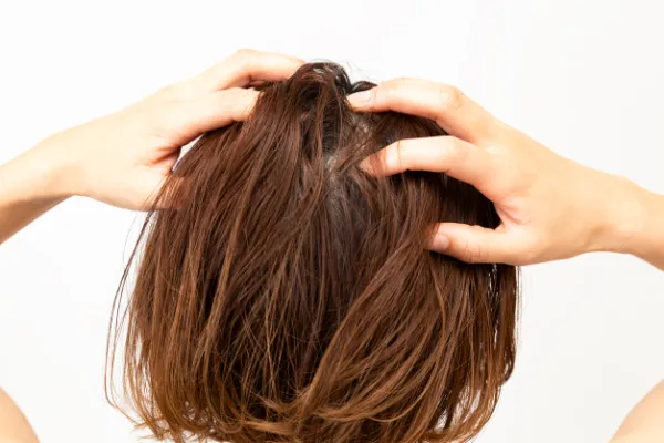 植毛して髪のボリュームが増えた女性