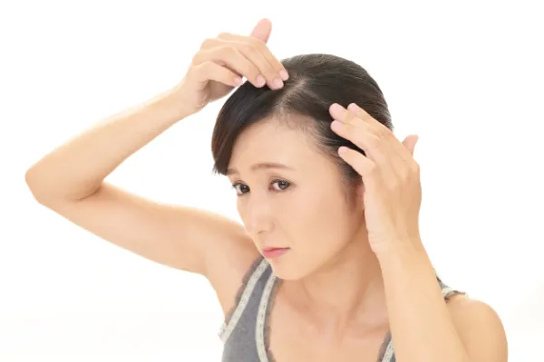 薄毛が気になる女性