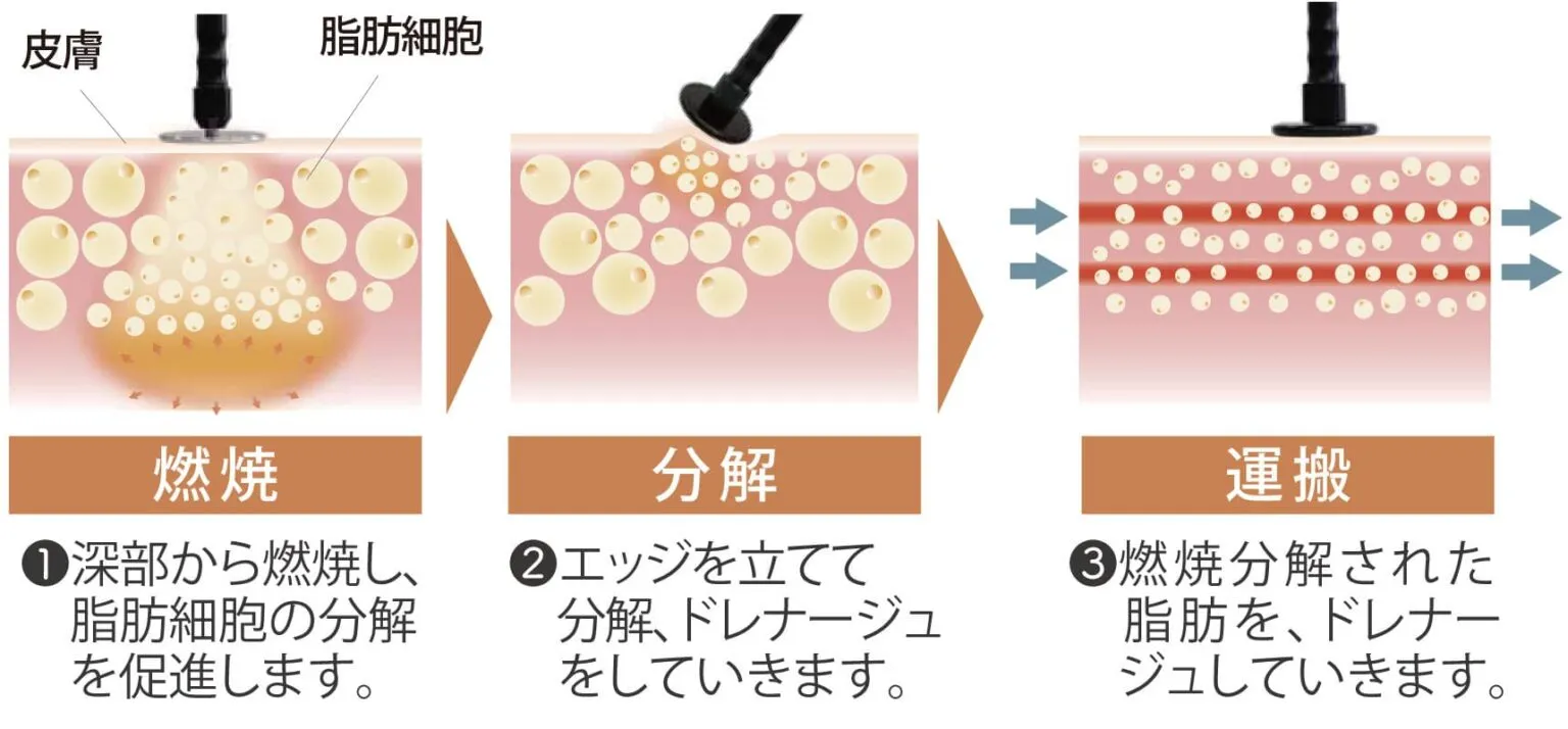 ラフォスの原理・仕組み