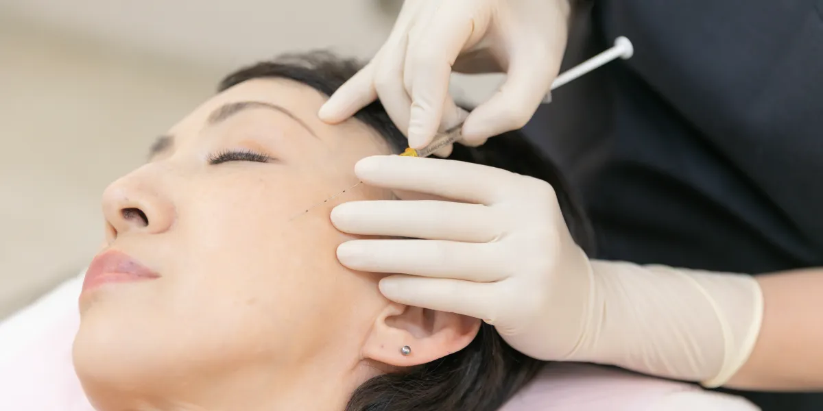 西千葉にある自由が丘クリニックソフィアの医師によるニキビ跡治療［サブシジョン＋ヒアルロン酸注射］