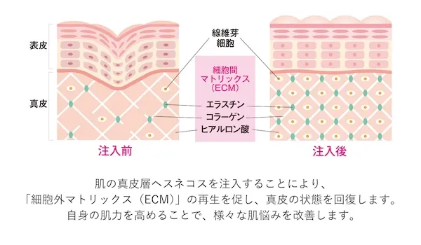 スネコスパフォルマの作用イメージ