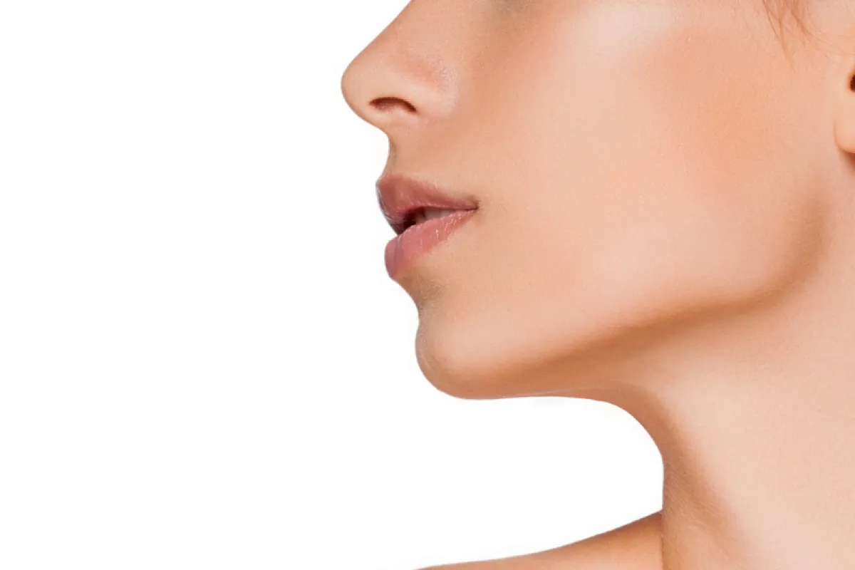 フェイスリフト