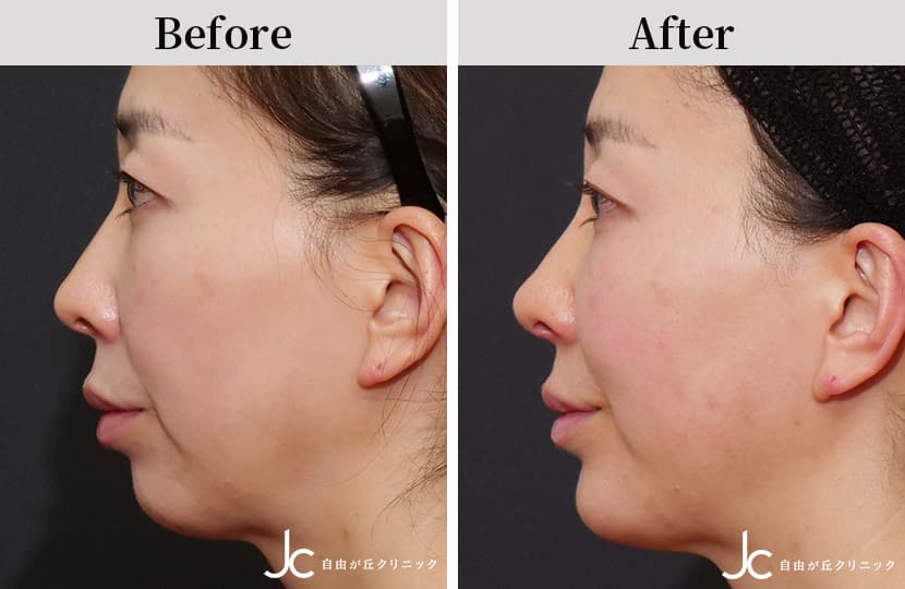 コンビネーション治療の症例:施術後