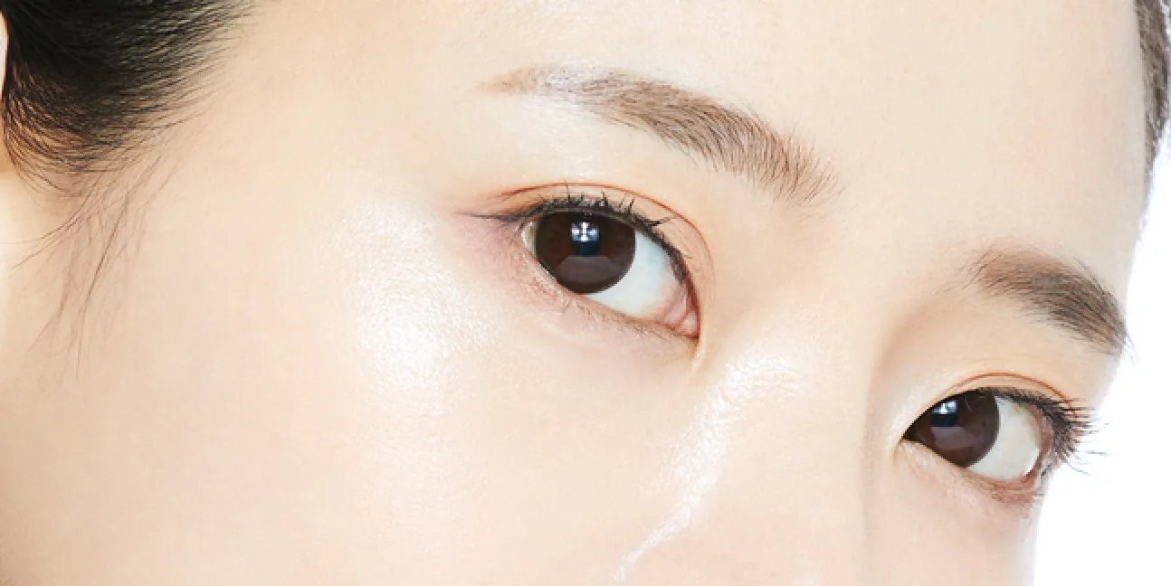 上まぶた・目の上のたるみ取り