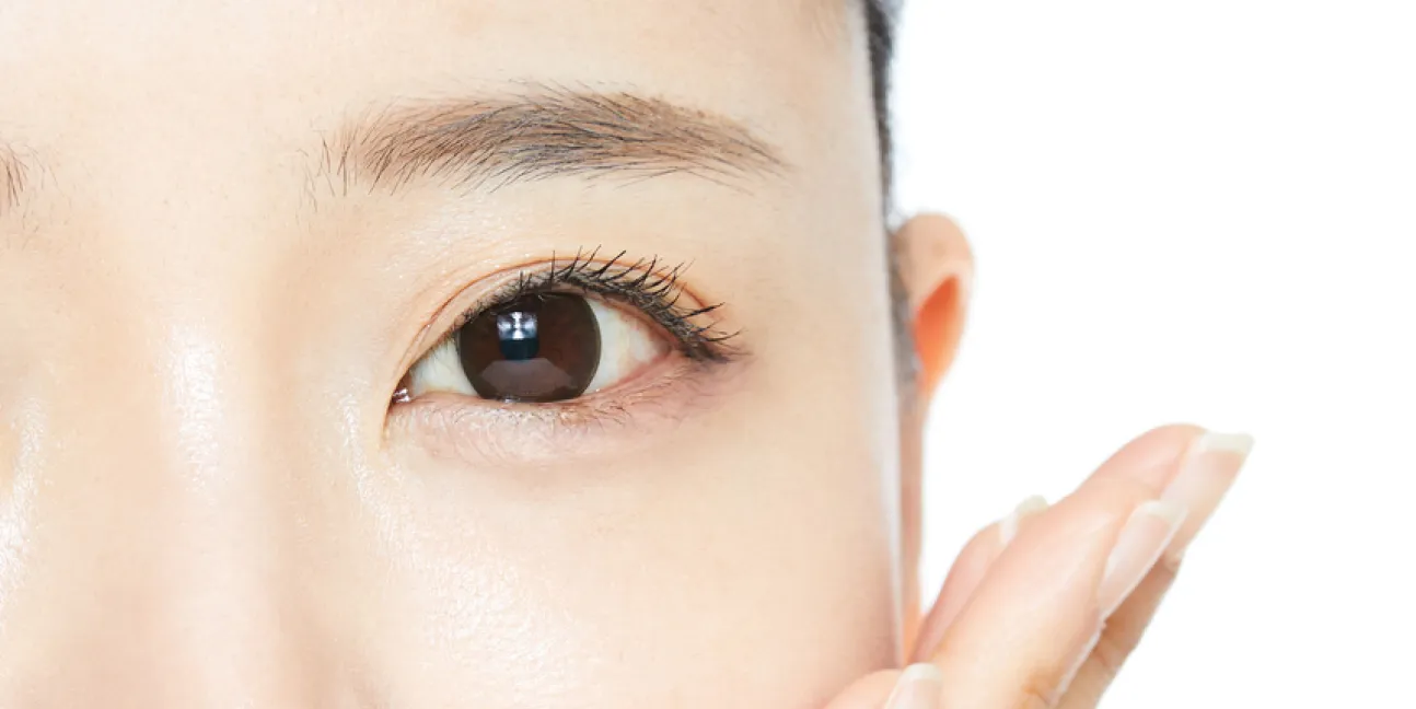 二重まぶた埋没法