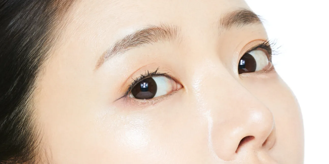 二重まぶた切開法